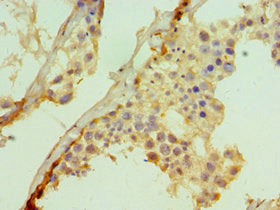 Immunohistochemistry of paraffin-embedded human testis tissue using SUFU Antibody at dilution of 1:100Rabbit anti-Human SUFU Polyclonal Antibody