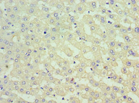 Immunohistochemistry of paraffin-embedded human liver tissue using SUFU Antibody at dilution of 1:100Rabbit anti-Human SUFU Polyclonal Antibody