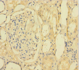 Immunohistochemistry of paraffin-embedded human kidney tissue using the antibody at dilution of 1:100Rabbit anti-Human PLA2G2D Polyclonal Antibody