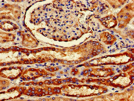 Immunohistochemistry of paraffin-embedded human kidney tissue using FZD1 Antibody at dilution of 1:100Rabbit anti-Human FZD1 Polyclonal Antibody