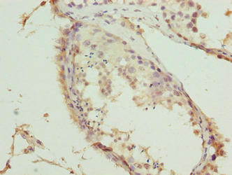 Immunohistochemistry of paraffin-embedded human testis tissue using TRMT6 Antibody at dilution of 1:100Rabbit anti-Human TRMT6 Polyclonal Antibody