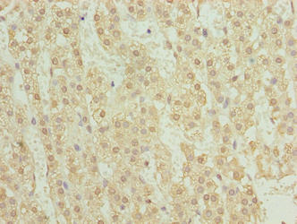 Immunohistochemistry of paraffin-embedded human adrenal gland tissue using TRMT6 Antibody at dilution of 1:100Rabbit anti-Human TRMT6 Polyclonal Antibody