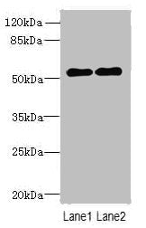 Western blot | All lanes: TRMT6 antibody at 4μg/ml | Lane 1: U251 whole cell lysate | Lane 2: HepG2 whole cell lysate | Secondary | Goat polyclonal to rabbit IgG at 1/10000 dilution | Predicted band size: 56, 45, 41, 37 kDa | Observed band size: 56 kDaRabbit anti-Human TRMT6 Polyclonal Antibody