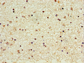 Immunohistochemistry of paraffin-embedded human brain tissue using CROT Antibody at dilution of 1:100Rabbit anti-Human CROT Polyclonal Antibody