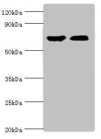 Western blot | All lanes: CROT antibody at 3μg/ml | Lane 1: Mouse kidney tissue | Lane 2: A431 whole cell lysate | Secondary | Goat polyclonal to rabbit IgG at 1/10000 dilution | Predicted band size: 71, 11, 74 kDa | Observed band size: 71 kDaRabbit anti-Human CROT Polyclonal Antibody