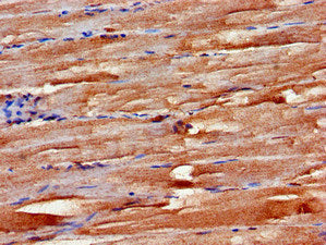 Immunohistochemistry of paraffin-embedded human skeletal muscle tissue using FBXW2 Antibody at dilution of 1:100Rabbit anti-Human FBXW2 Polyclonal Antibody