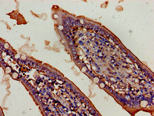 Immunohistochemistry of paraffin-embedded human small intestine tissue using FBXW2 Antibody at dilution of 1:100Rabbit anti-Human FBXW2 Polyclonal Antibody