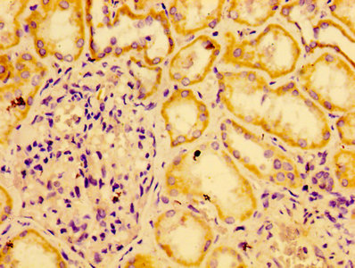 Immunohistochemistry of paraffin-embedded human kidney tissue using the antibody at dilution of 1:100Rabbit anti-Human AGO2 Polyclonal Antibody