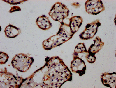 IHC image of AGO2 Antibody diluted at 1:1200 and staining in paraffin-embedded human placenta tissue performed on a Leica BondTM system. After dewaxing and hydration, antigen retrieval was mediated by high pressure in a citrate buffer (pH 6.0). Section was blocked with 10% normal goat serum 30min at RT. Then primary antibody (1% BSA) was incubated at 4°C overnight. The primary is detected by a biotinylated secondary antibody and visualized using an HRP conjugated SP system.Rabbit anti-Human AGO2 Polyclonal Antibody