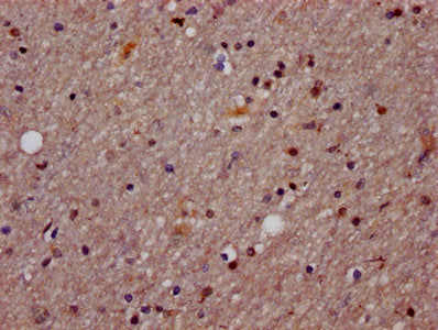 IHC image of AGO2 Antibody diluted at 1:1200 and staining in paraffin-embedded human brain tissue performed on a Leica BondTM system. After dewaxing and hydration, antigen retrieval was mediated by high pressure in a citrate buffer (pH 6.0). Section was blocked with 10% normal goat serum 30min at RT. Then primary antibody (1% BSA) was incubated at 4°C overnight. The primary is detected by a biotinylated secondary antibody and visualized using an HRP conjugated SP system.Rabbit anti-Human AGO2 Polyclonal Antibody