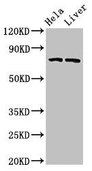 Western Blot  | Positive WB detected in: Hela whole cell lysate, Rat liver tissue  | All lanes: ACSL5 antibody at 3μg/ml  | Secondary  | Goat polyclonal to rabbit IgG at 1/50000 dilution  | Predicted band size: 76, 83, 74, kDa  | Observed band size: 76 kDa