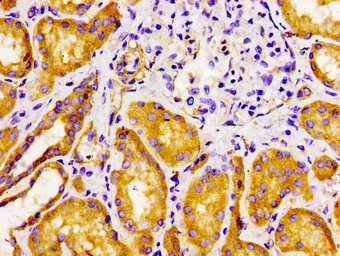 Immunohistochemistry of paraffin-embedded human kidney tissue using FZD10 Antibody at dilution of 1:100Rabbit anti-Human FZD10 Polyclonal Antibody