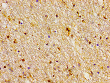 Immunohistochemistry of paraffin-embedded human brain tissue using FZD10 Antibody at dilution of 1:100Rabbit anti-Human FZD10 Polyclonal Antibody