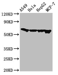 Western Blot | Positive WB detected in: A549 whole cell lysate, Hela whole cell lysate, HepG2 whole cell lysate, MCF-7 whole cell lysate | All lanes: FZD10 antibody at 3μg/ml | Secondary | Goat polyclonal to rabbit IgG at 1/50000 dilution | Predicted band size: 66 kDa | Observed band size: 66 kDaRabbit anti-Human FZD10 Polyclonal Antibody