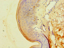 Immunohistochemistry of paraffin-embedded human skin tissue using CA14 Antibody at dilution of 1:100