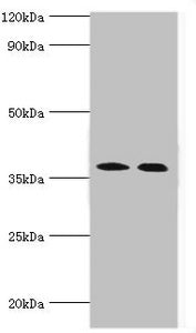 Western blot | All lanes: Carbonic anhydrase 14 antibody at 5μg/ml | Lane 1: Mouse liver tissue | Lane 2: Jurkat whole cell lysate | Secondary | Goat polyclonal to rabbit IgG at 1/10000 dilution | Predicted band size: 38 kDa | Observed band size: 38 kDa