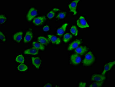 Immunofluorescence staining of A549 cells with SNX12 Antibody at 1:200, counter-stained with DAPI. The cells were fixed in 4% formaldehyde, permeabilized using 0.2% Triton X-100 and blocked in 10% normal Goat Serum. The cells were then incubated with the antibody overnight at 4°C. The secondary antibody was Alexa Fluor 488-congugated AffiniPure Goat Anti-Rabbit IgG(H+L).Rabbit anti-Human SNX12 Polyclonal Antibody