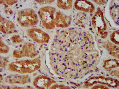 IHC image of SNX12 Antibody diluted at 1:600 and staining in paraffin-embedded human kidney tissue performed on a Leica BondTM system. After dewaxing and hydration, antigen retrieval was mediated by high pressure in a citrate buffer (pH 6.0). Section was blocked with 10% normal goat serum 30min at RT. Then primary antibody (1% BSA) was incubated at 4°C overnight. The primary is detected by a biotinylated secondary antibody and visualized using an HRP conjugated SP system.Rabbit anti-Human SNX12 Polyclonal Antibody
