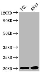 Western Blot  | Positive WB detected in: PC-3 whole cell lysate, A549 whole cell lysate  | All lanes: SNX12 antibody at 2.83µg/ml  | Secondary  | Goat polyclonal to rabbit IgG at 1/50000 dilution  | Predicted band size: 20, 19 kDa  | Observed band size: 20 kDaRabbit anti-Human SNX12 Polyclonal Antibody