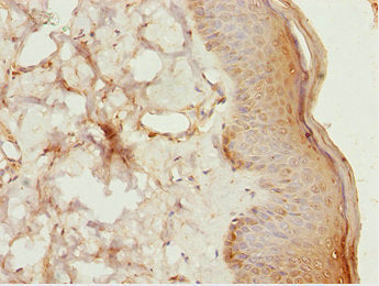 Immunohistochemistry of paraffin-embedded human skin tissue using LHX6 Antibody at dilution of 1:100