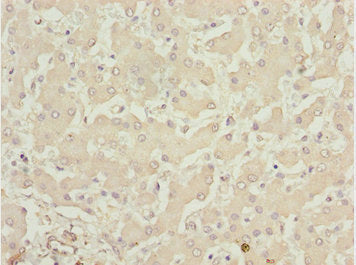 Immunohistochemistry of paraffin-embedded human liver tissue using LHX6 Antibody at dilution of 1:100