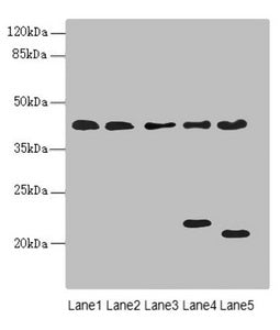 Western blot | All lanes: LHX6 antibody at 3.02μg/ml | Lane 1: HepG2 whole cell lysate | Lane 2: U87 whole cell lysate | Lane 3: NIH/3T3 whole cell lysate | Lane 4: Mouse brain tissue | Lane 5: Mouse liver tissue | Secondary | Goat polyclonal to rabbit IgG at 1/10000 dilution | Predicted band size: 41, 39, 44, 42, 20 kDa | Observed band size: 41, 22, 20 kDa