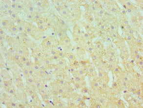 Immunohistochemistry of paraffin-embedded human liver tissue using SERPINA10 Antibody at dilution of 1:100Rabbit anti-Human SERPINA10 Polyclonal Antibody