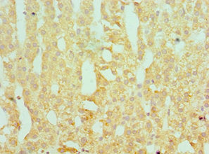 Immunohistochemistry of paraffin-embedded human adrenal gland tissue using SERPINA10 Antibody at dilution of 1:100Rabbit anti-Human SERPINA10 Polyclonal Antibody