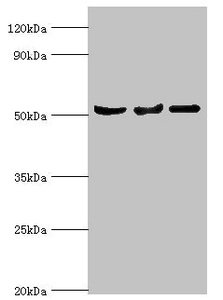 Western blot | All lanes: Protein Z-dependent protease inhibitor antibody at 3μg/ml | Lane 1: Mouse liver tissue | Lane 2: HepG2 whole cell lysate | Lane 3: LO2 whole cell lysate | Secondary | Goat polyclonal to rabbit IgG at 1/10000 dilution | Predicted band size: 51 kDa | Observed band size: 51 kDaRabbit anti-Human SERPINA10 Polyclonal Antibody