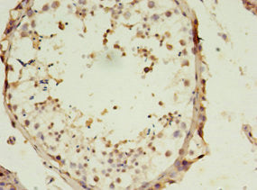 Immunohistochemistry of paraffin-embedded human testis tissue using SLC13A4 Antibody at dilution of 1:100Rabbit anti-Human SLC13A4 Polyclonal Antibody