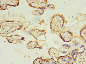 Immunohistochemistry of paraffin-embedded human placenta tissue using SLC13A4 Antibody at dilution of 1:100Rabbit anti-Human SLC13A4 Polyclonal Antibody