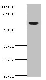 Western blot | All lanes: SLC13A4 antibody at 2μg/ml + 293T whole cell lysate | Secondary | Goat polyclonal to rabbit IgG at 1/10000 dilution | Predicted band size: 69 kDa | Observed band size: 69 kDaRabbit anti-Human SLC13A4 Polyclonal Antibody