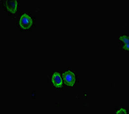 Immunofluorescent analysis of HepG2 cells using FBXL21 Antibody at dilution of 1:100 and Alexa Fluor 488-congugated AffiniPure Goat Anti-Rabbit IgG(H+L)Rabbit anti-Human FBXL21 Polyclonal Antibody