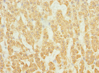 Immunohistochemistry of paraffin-embedded human adrenal gland tissue using RAB23 Antibody at dilution of 1:100Rabbit anti-Human RAB23 Polyclonal Antibody