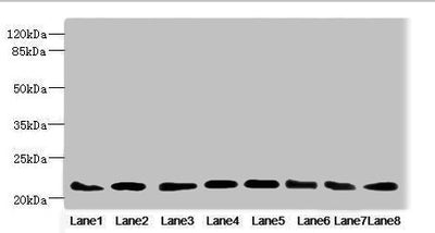 Western blot | All lanes: RAB23 antibody at 3.88μg/ml | Lane 1: Mouse ocular tissue | Lane 2: Rat brain tissue | Lane 3: Mouse kidney tissue | Lane 4: Mouse lung tissue | Lane 5: Mouse brain tissue | Lane 6: NIH/3T3 whole cell lysate | Lane 7: MCF-7 whole cell lysate | Lane 8: Hela whole cell lysate | Secondary | Goat polyclonal to rabbit IgG at 1/10000 dilution | Predicted band size: 27 kDa | Observed band size: 27 kDaRabbit anti-Human RAB23 Polyclonal Antibody