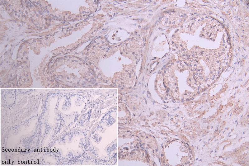 Immunohistochemistry of paraffin-embedded human lung tissue using VPS4A Antibody at dilution of 1:100Rabbit anti-Human VPS4A Polyclonal Antibody