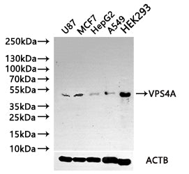 Western blot | All lanes: VPS4Aantibody at 4.28μg/ml | Lane 1: Mouse kidney tissue | Lane 2: Rat gonadal tissue | Lane 3: Mouse brain tissue | Lane 4: U87 whole cell lysate | Lane 5: MCF-7 whole cell lysate | Secondary | Goat polyclonal to rabbit IgG at 1/10000 dilution | Predicted band size: 49 kDa | Observed band size: 49 kDaRabbit anti-Human VPS4A Polyclonal Antibody