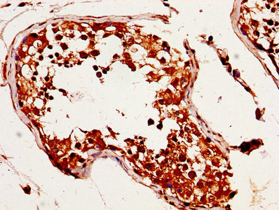 IHC image of MAGED2 Antibody diluted at 1:320 and staining in paraffin-embedded human testis tissue performed on a Leica BondTM system. After dewaxing and hydration, antigen retrieval was mediated by high pressure in a citrate buffer (pH 6.0). Section was blocked with 10% normal goat serum 30min at RT. Then primary antibody (1% BSA) was incubated at 4°C overnight. The primary is detected by a biotinylated secondary antibody and visualized using an HRP conjugated SP system.