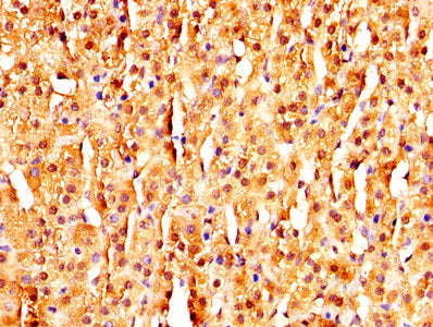 IHC image of MAGED2 Antibody diluted at 1:320 and staining in paraffin-embedded human adrenal gland tissue performed on a Leica BondTM system. After dewaxing and hydration, antigen retrieval was mediated by high pressure in a citrate buffer (pH 6.0). Section was blocked with 10% normal goat serum 30min at RT. Then primary antibody (1% BSA) was incubated at 4°C overnight. The primary is detected by a biotinylated secondary antibody and visualized using an HRP conjugated SP system.