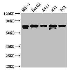 Western Blot  | Positive WB detected in: MCF-7 whole cell lysate, HepG2 whole cell lysate, A549 whole cell lysate, 293 whole cell lysate, PC-3 whole cell lysate  | All lanes: MAGED2 antibody at 4.5µg/ml  | Secondary  | Goat polyclonal to rabbit IgG at 1/50000 dilution  | Predicted band size: 65, 64 kDa  | Observed band size: 65, 64 kDa