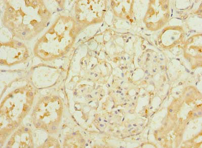Immunohistochemistry of paraffin-embedded human kidney tissue using PA2G4 Antibody at dilution of 1:100Rabbit anti-Human PA2G4 Polyclonal Antibody