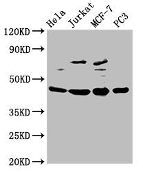 Western Blot | Positive WB detected in: Hela whole cell lysate, Jurkat whole cell lysate, MCF-7 whole cell lysate, PC-3 whole cell lysate | All lanes: PA2G4 antibody at 2.5μg/ml | Secondary | Goat polyclonal to rabbit IgG at 1/50000 dilution | Predicted band size: 44, 39 kDa | Observed band size: 44 kDaRabbit anti-Human PA2G4 Polyclonal Antibody