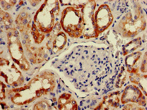 Immunohistochemistry of paraffin-embedded human kidney tissue using the antibody at dilution of 1:100