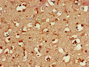 Immunohistochemistry of paraffin-embedded human brain tissue using BAIAP2 Antibody at dilution of 1:100