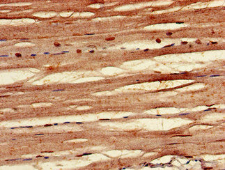 Immunohistochemistry of paraffin-embedded human skeletal muscle tissue using the antibody at dilution of 1:100Rabbit anti-Human FBXO3 Polyclonal Antibody