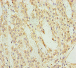 Immunohistochemistry of paraffin-embedded human adrenal gland tissue using ACSL6 Antibody at dilution of 1:100