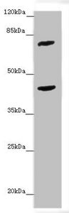 Western blot | All lanes: ACSL6 antibody at 4.25 μg/ml + Mouse liver tissue | Secondary | Goat polyclonal to rabbit IgG at 1/10000 dilution | Predicted band size: 78, 81, 75, 77, 80, 70 kDa | Observed band size: 78, 42 kDa