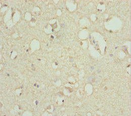 Immunohistochemistry of paraffin-embedded human brain tissue using ACSL6 Antibody at dilution of 1:100