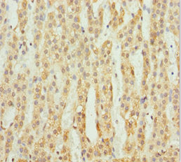 Immunohistochemistry of paraffin-embedded human adrenal gland tissue using ACSL6 Antibody at dilution of 1:100