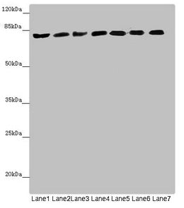 Western blot  | All lanes: ACSL6 antibody at 4.64µg/ml  | Lane 1: Mouse liver tissue  | Lane 2: Mouse heart tissue  | Lane 3: Mouse brain tissue  | Lane 4: Mouse gonadal tissue  | Lane 5: Jurkat whole cell lysate  | Lane 6: Raji whole cell lysate  | Lane 7: K562 whole cell lysate  | Secondary  | Goat polyclonal to rabbit IgG at 1/10000 dilution  | Predicted band size: 78, 81, 75, 77, 80, 70 kDa  | Observed band size: 78 kDa